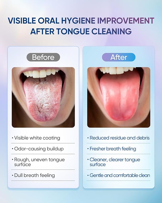 BodyAccel Tongue Cleaner Gel with Tongue Brush – Fresh Breath Oral Care Kit – Tongue Scraper Gel Set for Bad Breath Removal, Maintain Oral Health