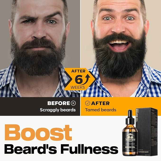 Waking Forest Vanilla Beard Oil for Men 60 ml - Biotin Mustache Oil with Vitamin E, Rosemary & Castor - Beard Care Softener, Strengthens, and Moisturizes - Beard Conditioner (2 oz)