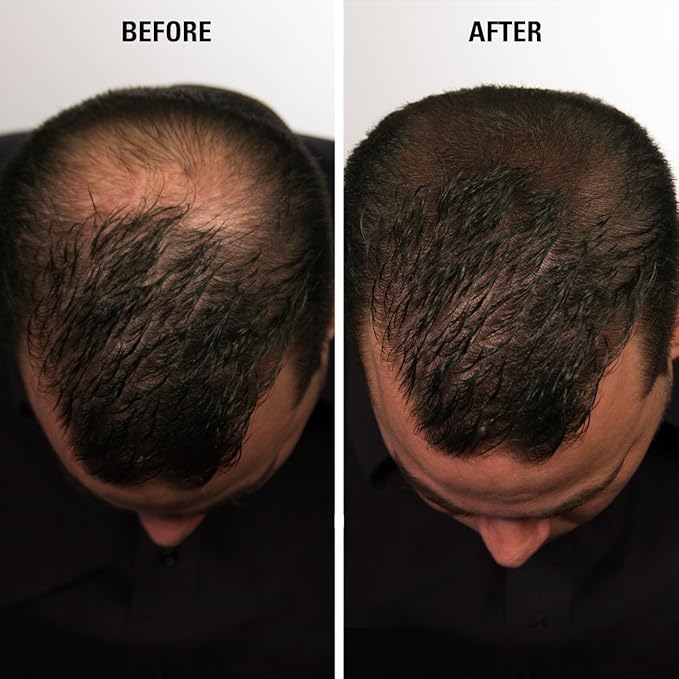 ECLIPSE Hair Fibers Grey for Thinning Hair for Women & Men to Conceal Hair Loss in 15 Seconds - 100% Undetectable Hair Building Fibers, 15g