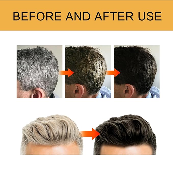 Gray Hair Reverse Bar, Black Hairs Soap For Men & Women, Hydrating & Moisturizing Scalp Care, For Gray Beard & Mane (2)