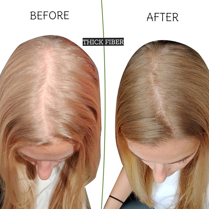 THICK FIBER Hair Fibers for Thinning Hair & Bald spots (MEDIUM BLONDE) - 25g Bottle - Conceals Hair Loss in Seconds - Hair Powder for Women & Men