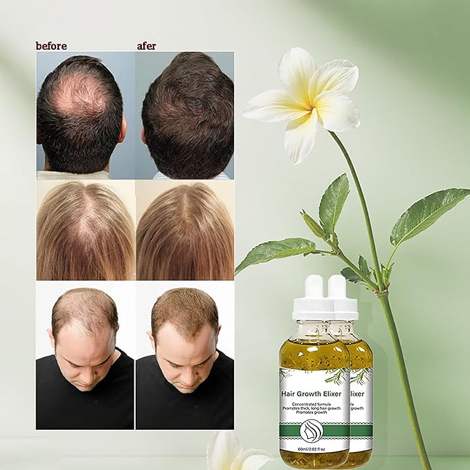 Hair Growth Serum with Rosemary Oil, Activates Follicles, Reduces Shedding & Strengthens Hair, Scalp Care Treatment for Healthier Looking Hair, 2.02 Fl Oz 2-Pack for Men & Women