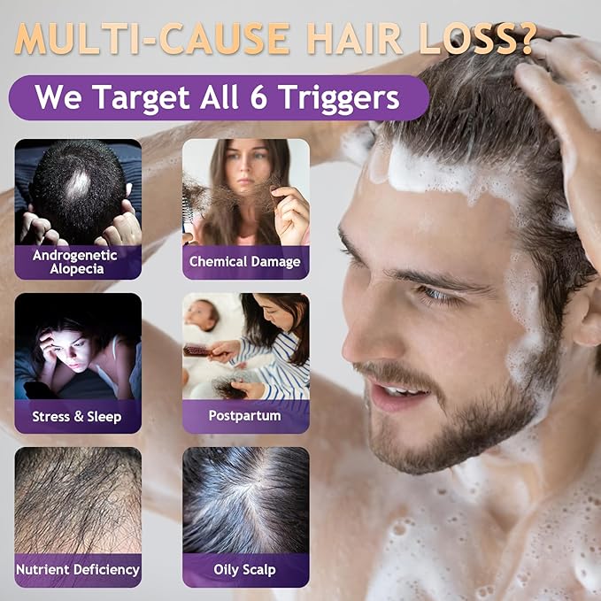 Biotin Hair Growth & Thickening Shampoo with Root Activator, Hair Loss Shampoo for Men And Women, Strengthen Roots, Control Oil & Thicken Thin Hair, Sulfate-Free, for All Hair Types, 10.1 Fl Oz-Fresh