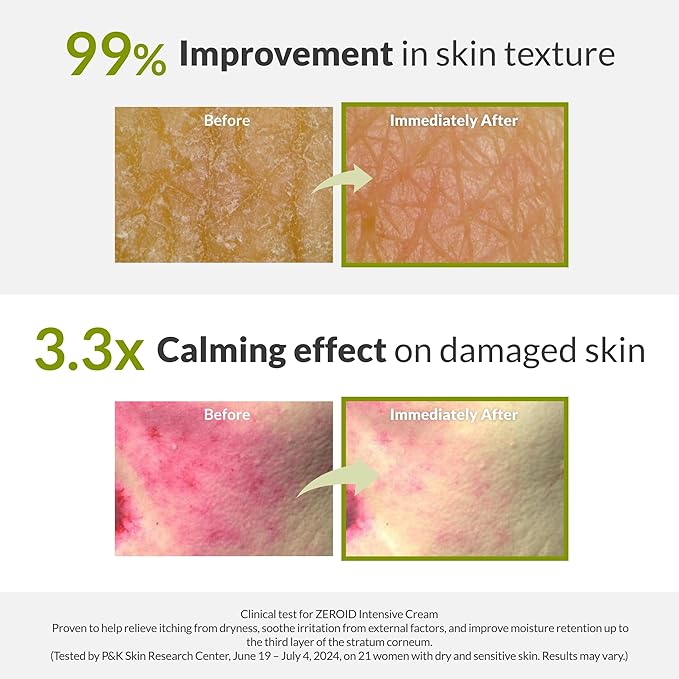 ZEROID | Intensive Cream | Face Moisturizer for Dry & Disordered Skin | Face Cream for Sensitive Skin | Face Lotion For Skin Barrier Repair | Korean Skincare | Korean Moisturizer | 2.7 fl oz (80ml)