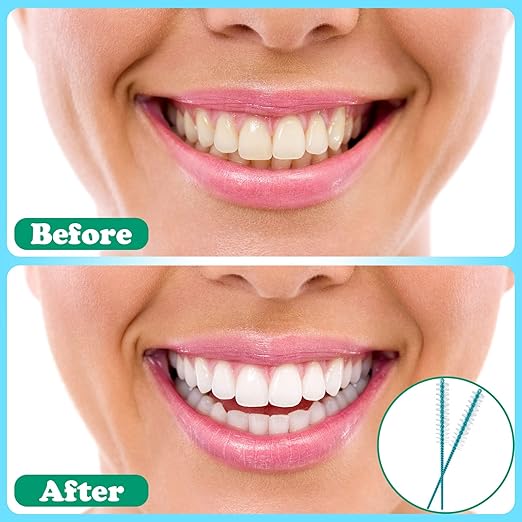 Interdental Brush Dental Picks Tooth Floss Interdental Brush Between Teeth Refills White Refills for Tooth Cleaning(100 Pieces,Tight)