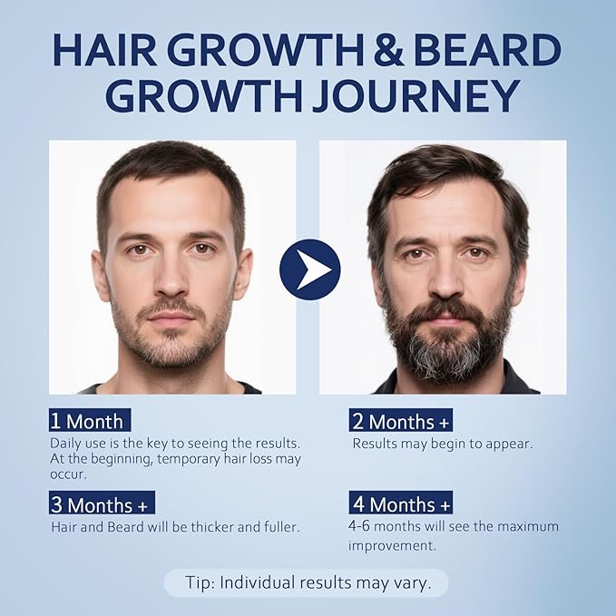5% Minoxidil Hair Growth Serum for Men & Women with Biotin: Minoxidil for Men and Women, 5 Percent, Hair Regrowth Treatment, Extra Strength (6 FL OZ, Dropper 3pcs)