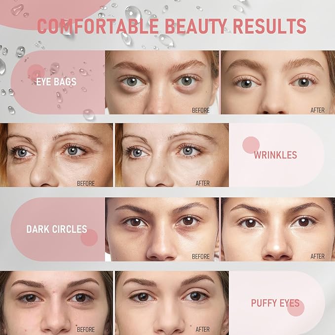 LAVONE Eye Mask - 30 Pairs Milk Under Eye Patches Skin Care Products - Eye Masks Skincare for Dark Circles and Puffiness, Reduce Wrinkles, Eye Bags and Fine Lines, for Women and Man