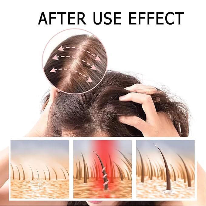 2 Box Ginger Plant Extract Shampoo for Hair Growth and Anti-Loss Control, Hair Growth Oil Care by Ginaday