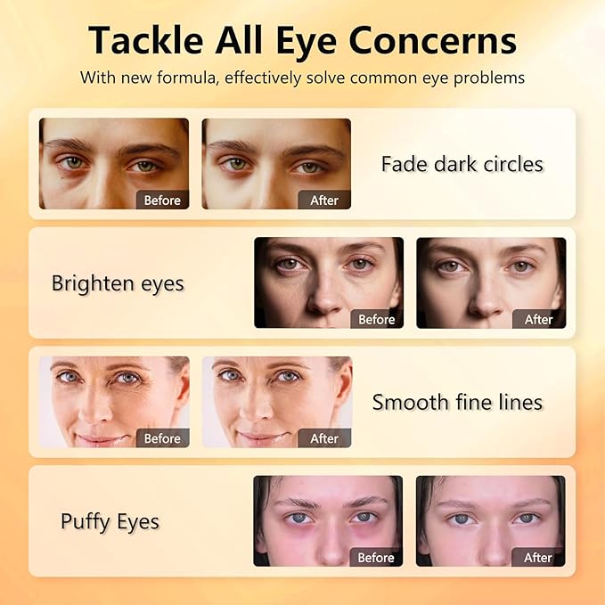 Under Eye Patches with Vitamin C & Caffeine 30 Pairs for Dark Circles, Fine Lines and Puffiness, with Niacinamide Hydra-Gel Collagen, Skin Care for Men & Women - 2 PACK