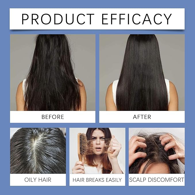 30ml Hair Growth Serum Roll On for Thinning Hair – Scalp Treatment with Ginger & Rosemary Oil to Reduce Hair Loss, Strengthen Roots & Nourish Dry Itchy Scalp
