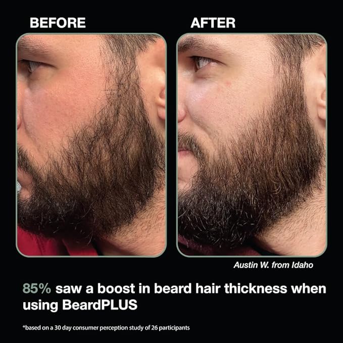 ZEUS BeardPlus Growth Serum for Men, Refined Beard Oil with Biotin, Caffeine & Collagen for Thicker, Fuller, Softer Facial Hair & Healthy Skin Care (Made in USA) 1.6 oz