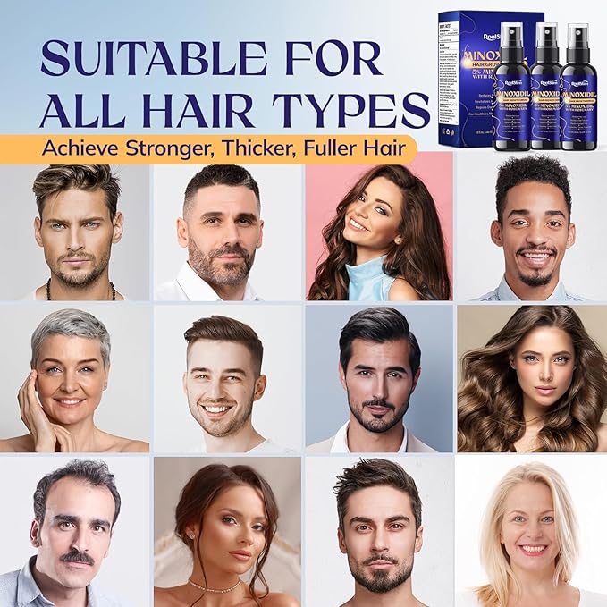 5% Minoxidil Kit for Men and Women – 3-Pack Beard Growth Kit & Hair Regrowth Spray – Targets Thinning Hairlines, Crowns & Patchy Beards – 180 mL
