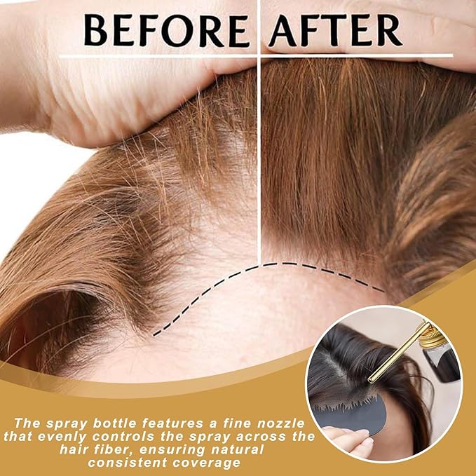 Hair Building Fiber Spray With Hairline Optimizer,Hair Building Fibers,Hair Fiber Spray,Powder Sprayer For Hair-Building, Portable Fiber Powder With Nozzle, Hairline Building Powder Accessory(Gold)