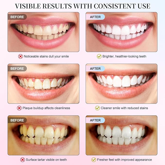 Niacinamide Whitening Toothpaste, Niacinamide Toothpaste Intensive Whitens Teeth, Stain Removal, Protects Tooth Enamel, Freshening Breath All Day with Natural Mint &Peach Flavor (1PC)
