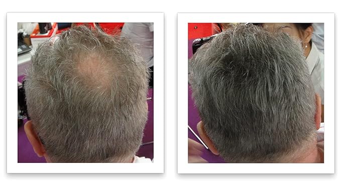 Caboki Hair Building Fiber + Built-In Spray Applicator (30-50 days supply). Salt & Pepper Light