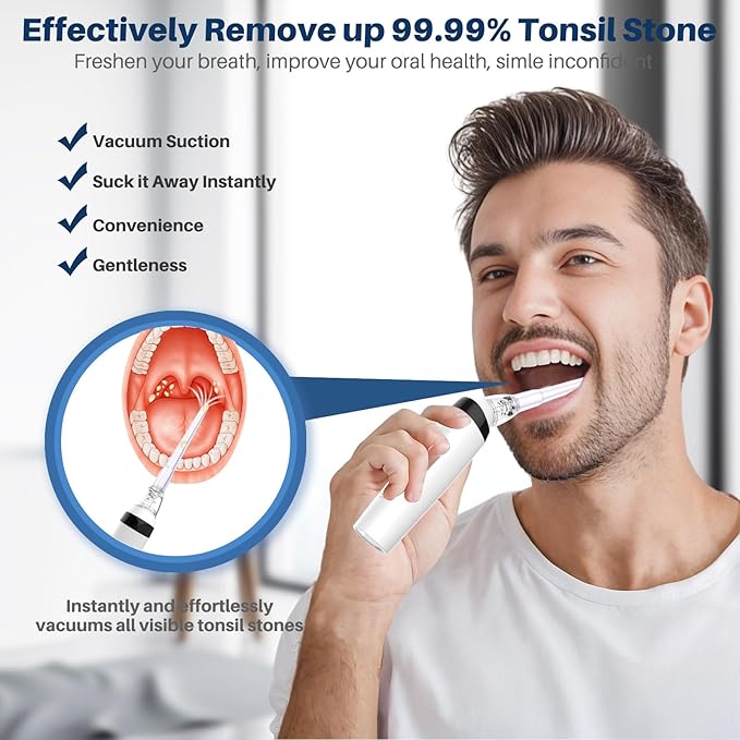 Voraiya Tonsil Stone Remover, Electronic Vacuum Tonsil Stone Removal Kit, 8 Suction Mode, Built-in LED Light, Fight Bad Breath, Oral Irrigator, Tonsil Cleaner, Tongue Scraper (White)