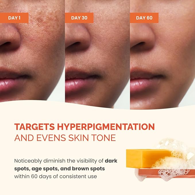 PLANTIFIQUE Kojic Acid Soap for Hyperpigmentation - Turmeric Soap 2 Bars with Hyaluronic Acid, Collagen, Vitamin C for Dark Spots - Face Wash for Women and Men, Vegan Skincare, 160g / 5.64 oz