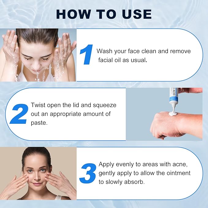 Azelaic Acid 10% Cream for Face - Acne Cream for Rosacea Reducing Relief Pimple Breakouts Blackhead Pigmentation and Redness - Azelaic Acid Gel For Facial and Skin Care