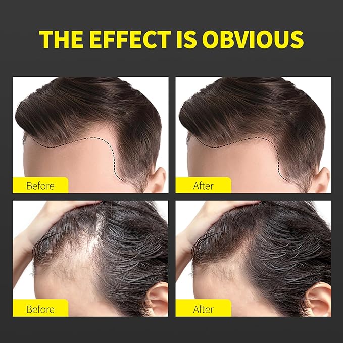 Sevich Hair Fiber Spray for Thinning Hair - Hair Building Fibers Instant Thickening for Men & Women, Waterproof & Sweatproof Root Touch Up Spray, 120ml (Dark Brown)