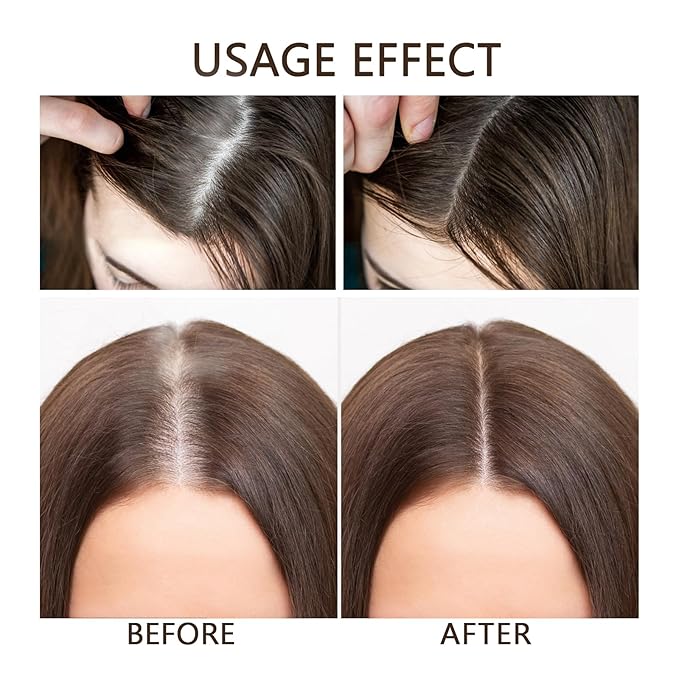 Ginger Hair Growth Shampoo,Anti Hair Loss Shampoo with Ginger Plant Extract, Instant Regrowth Organic Natural Gingers Repairs Damaged Hair Suitable for All Hair Types 8.8Fl Oz