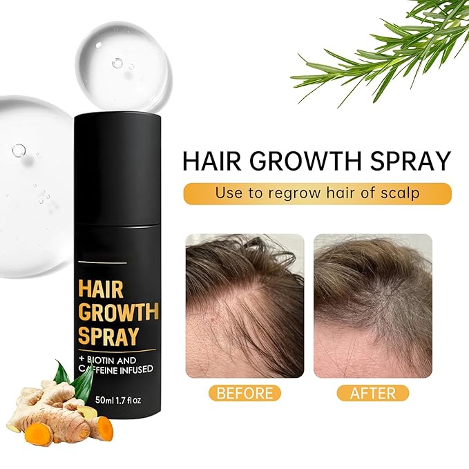 5% Minoxidil Hair Growth Spray for Fuller Hair, Enhance Hair Vitality & Shine, Suitable for All Hair Types For Women & Men, 1.7floz/50ml