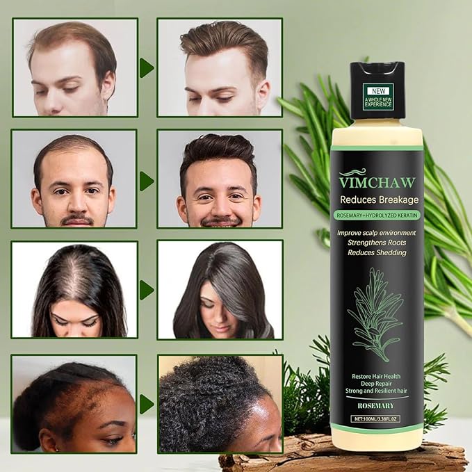 Organic Rosemary Hair Growth Shampoo,Strengthening Shampoo with Hydrolyzed Keratin and natural extract of rosemary for Thinning Hair & Hair Loss (1 bottle)