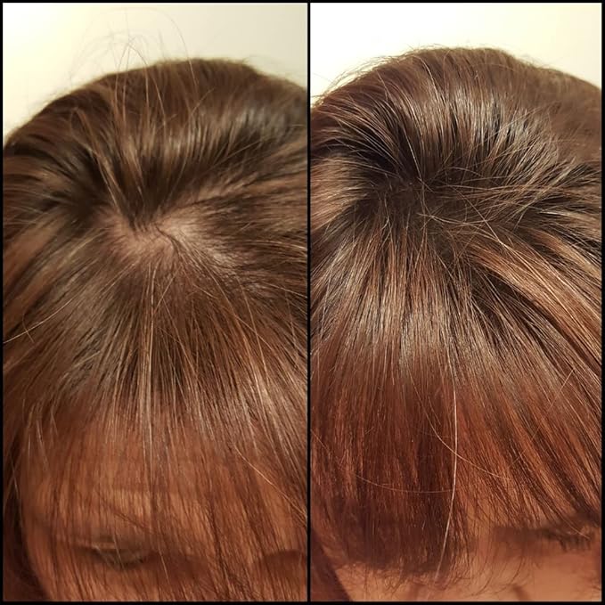 Caboki Hair Building Fiber + Built-in Spray Applicator (30-50 Days Supply). Auburn