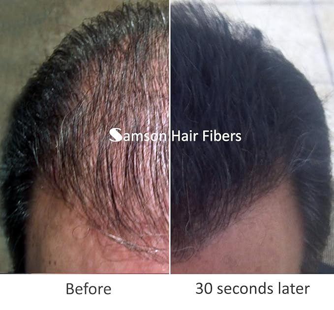for Thinning Hair - 100% Undetectable Natural Formula - Completely Conceals Hair Loss in Seconds. Covers bald spots. Thicken your hair instantly - 25 Grams Refill (MED. BROWN)