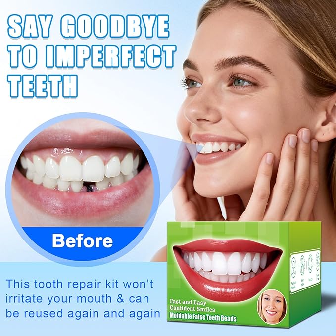 Moldable False Teeth Beads - Temporary Tooth Repair Kit | Fix Broken, Chipped Teeth, Cavity Temporary Fillings, Missing Tooth Gaps & Loose Dentures Within Minutes at Home