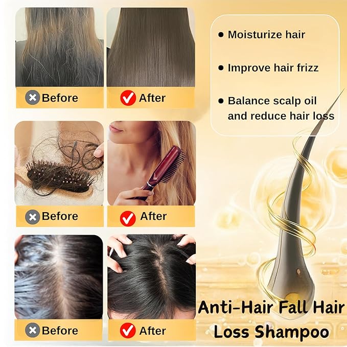 Generic 2Pcs Anti-Hair Fall Hair Loss Shampoo, Anti-Hair Fall Promote Hair Growth, Rich in Various Plant Extracts Moisturize, Suitable For All Hair Type