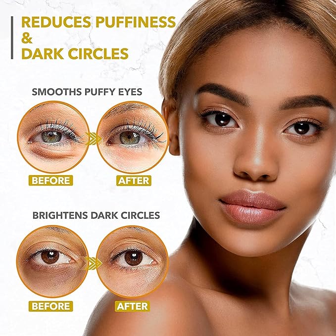 Under Eye Mask for Dark Circles and Puffiness, Wrinkles, 24k Gold Under Skincare Treatment Patches for Puffy Eyes with Collagen for Women and Men - Gel Pads - 30 Pairs