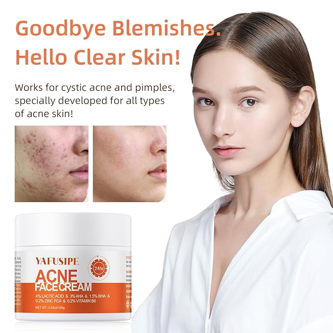 Acne Treatment for Face for Hormonal Cystic Stubborn Acne Cream for Sensitive Skin Teens Adults Women Men Spot Pimple Butt Control Rapid Clearing Breakout Overnight Face Blemish Treatment