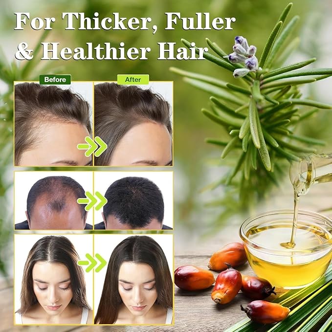 Batana Oil for Hair Growth with Rosemary Serum, Scalp Treatment for Thinning Hair Regrowth Thickening, Strength Hair Root for Women Men Hair Care (1 Pcs)
