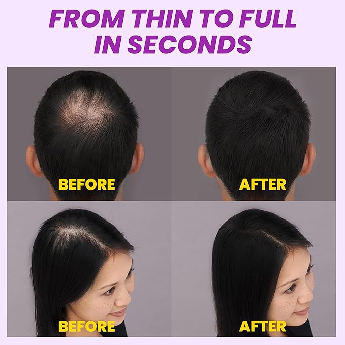 Hair Fibers for Thinning Hair, Hair Fibers with Spray Applicator Nozzle, Undetectable Finish for Hair & Beard, Long-lasting Hair Loss Concealer for Women & Men (Dark Brown, 30g)
