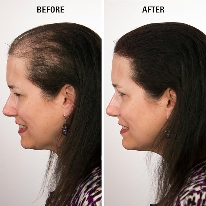 ECLIPSE Hair Fibers Auburn for Thinning Hair for Women & Men to Conceal Hair Loss in 15 Seconds - 100% Undetectable Hair Building Fibers, 30g