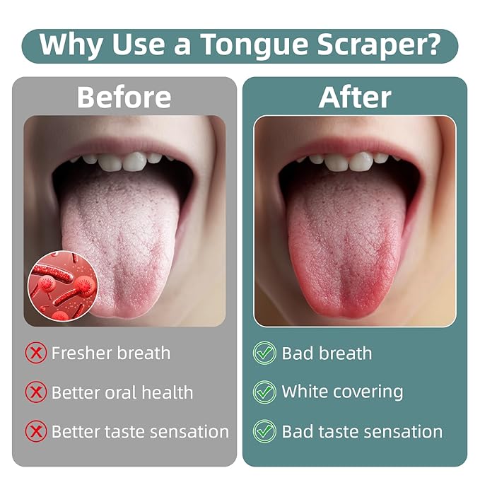 Tongue Scraper for Adults Stainless Steel Tongue Cleaner Brush 2-Packs, Silver