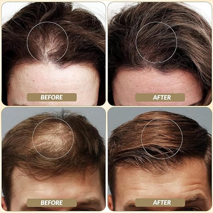 SOVONCARE Hair Fibers for Thinning Hair Auburn, Hair Building Fibers for Bald Spots Undetectable & Natural, Conceals Hair Loss Fill In Fine, Hair Powder Hair Thicker Instantly for Women & Men 28g