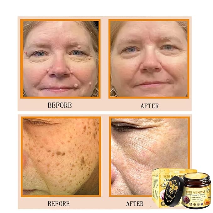 Bee Venom Comprehensive Cream, 2025 New Skincare Treatment Bee Venom Skin Cream, Visibly reduces skin blemishes, Natural Skin Moisturizer for Face and Body
