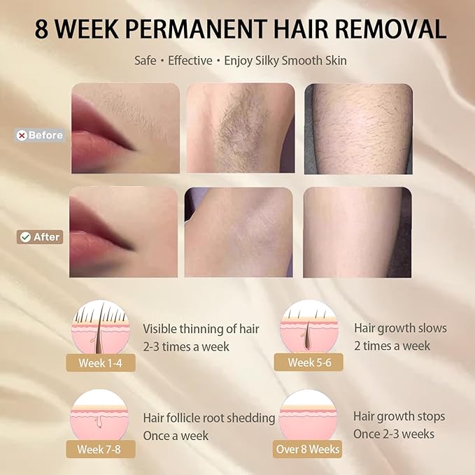 Hair Removal Device, 5 Levels