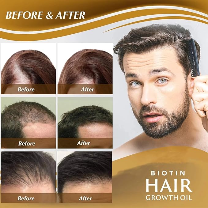 Biotin Hair Growth Serum，Hair Growth Spray Containing Ginseng Root Extract and Ginger Root Extract，Moisturizes the scalp, strengthens hair follicles, prevents hair loss, and promotes hair growth.