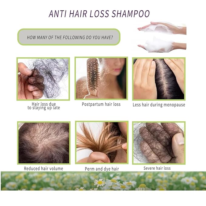 Anti-Hair Fall Hair Loss Shampoo 300ml/10.58 oz, Anti-Hair Fall Promote Hair Growth, Rich in Various Plant Extracts for Women Treatment, Volumizing and Moisturizing, All Types