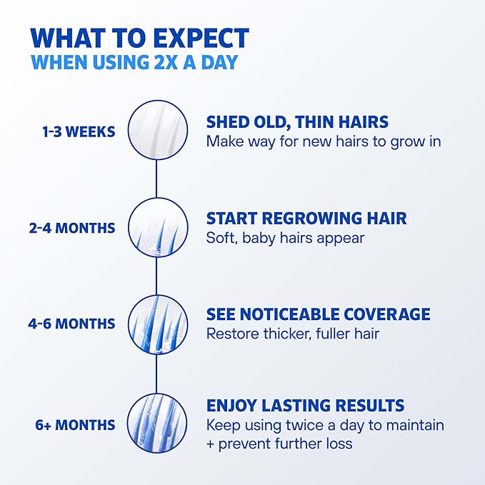 Men's Rogaine Extra Strength 5% Minoxidil Topical Solution for Hair Loss & Regrowth, Topical Treatment for Men, Unscented Minoxidil Follicle Booster Liquid, 1-Month Supply, 2 fl. oz