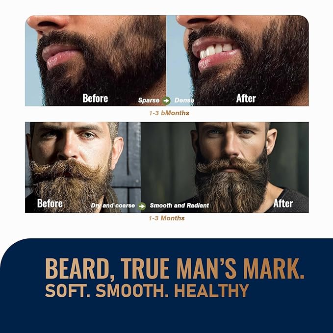 Biotin Beard Growth Kit for Men with Conditioning Oil and 0.25mm Massager Roller, Sandalwood Serum with Castor and Jojoba Oil, Grooming Softer Thicker Healthier-Looking Mustache Beard Care