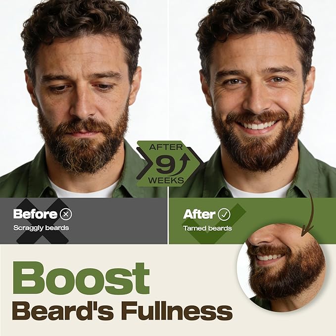 Waking Forest Beard Growth Oil for Men, Natural Sandalwood with Argan, Castor & Biotin, Vitamin E, Nourishes Thicker Softer Fuller Beard, Premium Gift for Bearded Gentlemen (120ml / 4 fl oz)