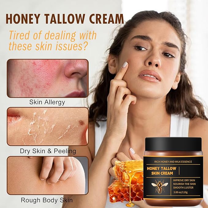 Beef Tallow Honey Balm for Skin & Face, Whipped Beef Tallow Face Moisturizer with Honey, Grass Fed Beef Tallow Cream, All Natural Pure Body Lotion for Women & Men Dry Sensitive Skin, 3.88 OZ