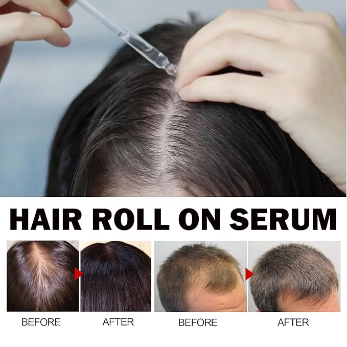 30ml Jojoba Oil Hair Growth Serum for Thinning Hair – Organic Hair Oil for Hair Loss, Dry Scalp & Damaged Hair – Nourishing Scalp Treatment for Men and Women