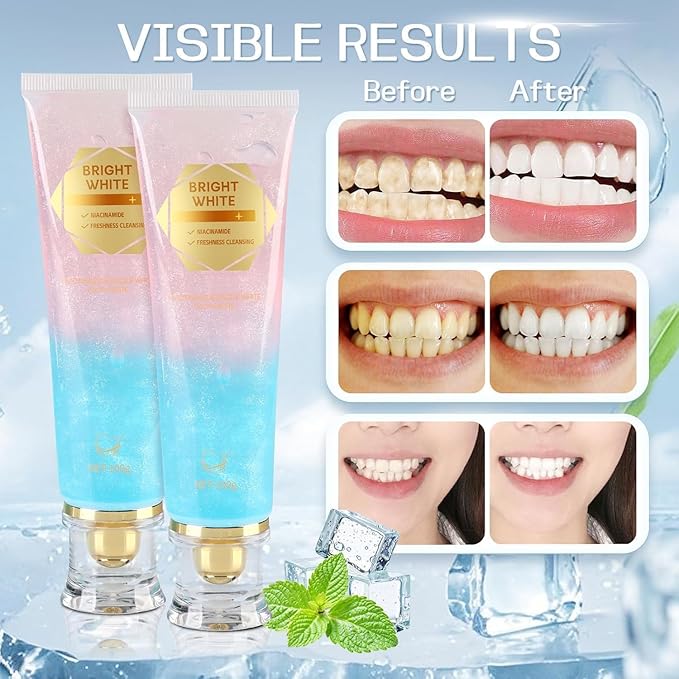 Niacinamide Whitening Toothpaste, Niacinamide Intensive Whitening Toothpaste, Enamel Protection & Long-Lasting Fresh Breath, Stain Removal - Daily Use for Improves Gum Health, Deep Cleaning Care (2)
