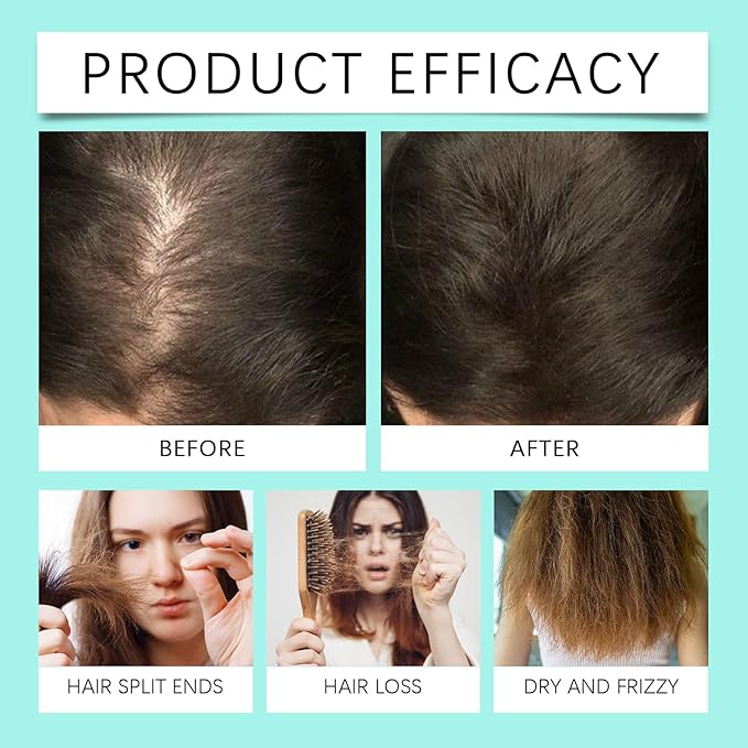 100ml Rosemary Hair Growth Tonic Spray - Anti Hair Loss Treatment with Caffeine & Basil Extract - Scalp Moisturizer for Dry & Sensitive Scalp - Promotes Thicker, Fuller & Healthier Hair
