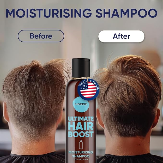 Moerie Ultimate Hair Growth Shampoo – For Longer, Thicker, Fuller Hair - Vegan Friendly Volumizing Hair Products – Paraben & Silicone Free – All Hair Types