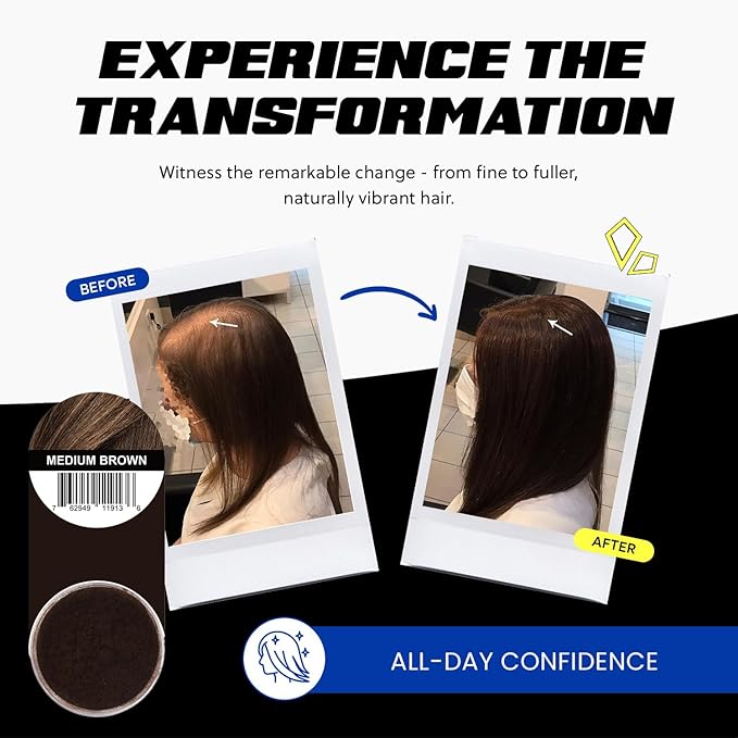 PrimeLook Hair Building Fibers, Luxurious Building Fibers for Thinning Hair, Superior Formula for Men & Women, Instant Volume, Matches Colors (27.5g, Medium Brown)